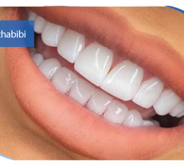 دکتر بهروز حبیبی - متخصص ایمپلنت - جراحی لثه زعفراینه - متخصص ایمپلنت در تهران