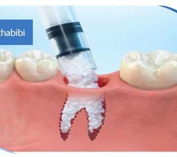 دکتر بهروز حبیبی - متخصص ایمپلنت - جراحی لثه زعفراینه - متخصص ایمپلنت در تهران