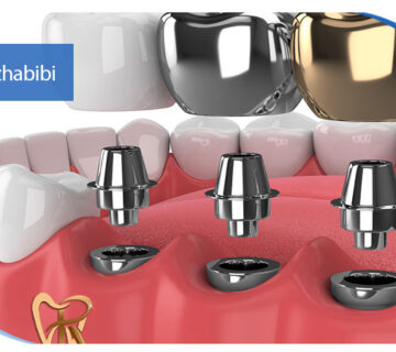 دکتر بهروز حبیبی - متخصص ایمپلنت - جراحی لثه زعفراینه - متخصص ایمپلنت در تهران