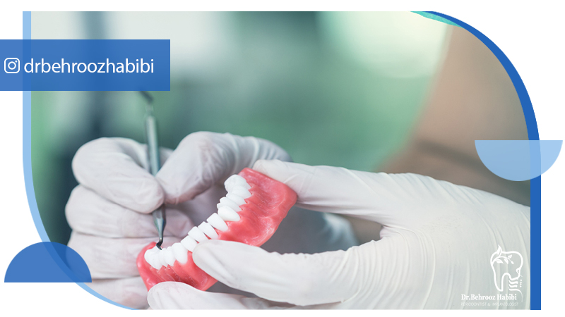 دکتر بهروز حبیبی - متخصص ایمپلنت - جراحی لثه زعفراینه - متخصص ایمپلنت در تهران