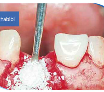 دکتر بهروز حبیبی - متخصص ایمپلنت - جراحی لثه زعفراینه - متخصص ایمپلنت در تهران