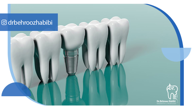 بهترین متخصص ایمپلنت در تهران | دکتر بهروز حبیبی