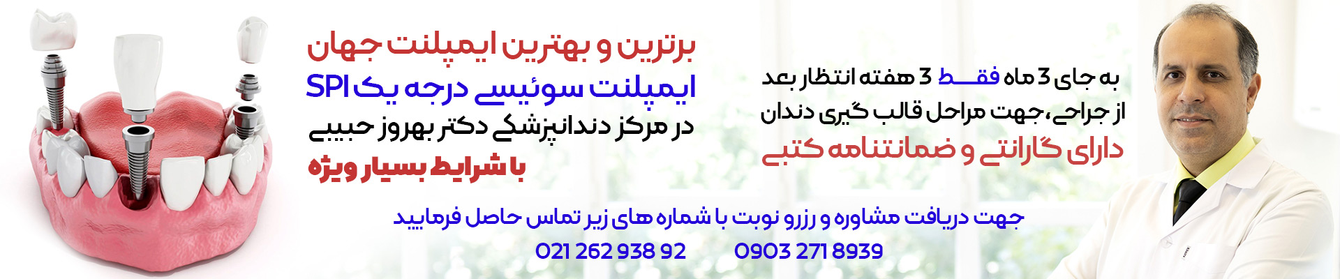 ایمپلنت سوییسی SPI (مخفف نوآوری دقت سوییسی)