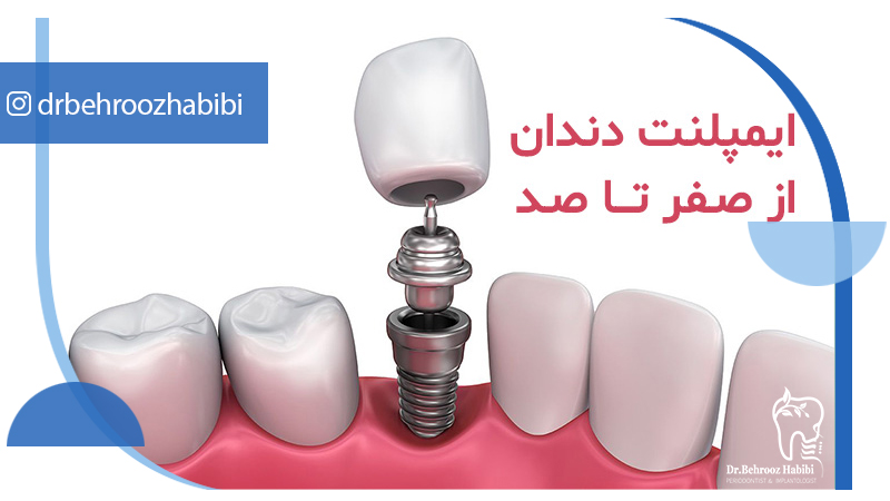بهترین متخصص ایمپلنت در تهران | دکتر بهروز حبیبی