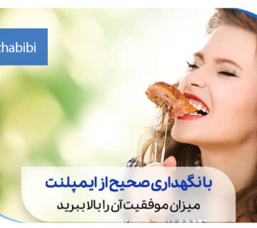 بهترین دکتر متخصص ایمپلنت در تهران | دکتر بهروز حبیبی