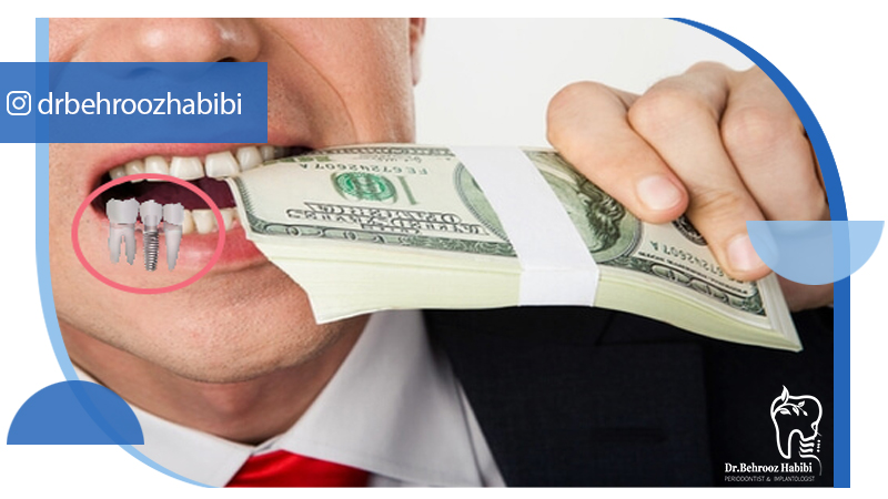 بهترین دکتر ایمپلنت در تهران | دکتر بهروز حبیبی