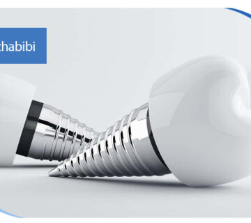 متخصص ایمپلنت تهران | بهترین متخصص ایمپلنت در زعفرانیه تهران