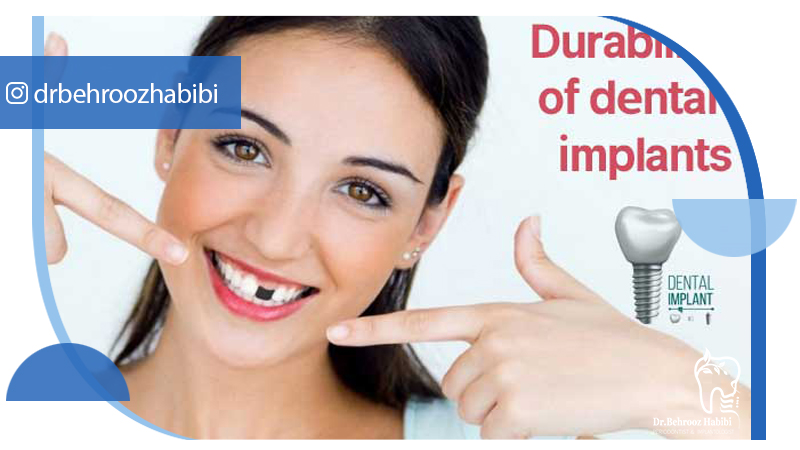 متخصص ایمپلنت تهران | بهترین متخصص ایمپلنت در زعفرانیه تهران