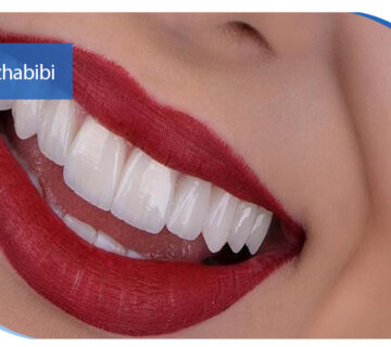 بهترین دکتر ایمپلنت در تهران | دکتر بهروز حبیبی