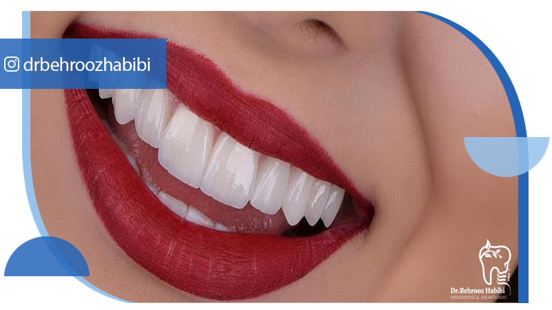 بهترین دکتر ایمپلنت در تهران | دکتر بهروز حبیبی