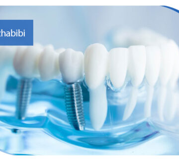 متخصص ایمپلنت تهران | بهترین متخصص ایمپلنت در زعفرانیه تهران