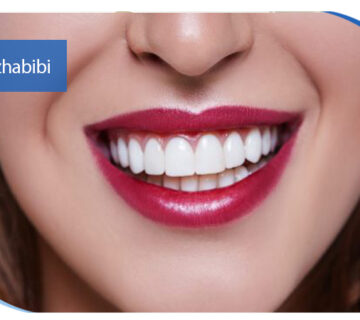 بهترین دکتر ایمپلنت در تهران | دکتر بهروز حبیبی