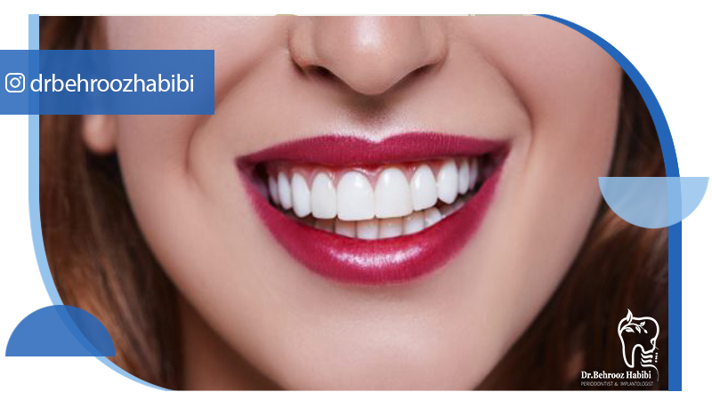 بهترین دکتر ایمپلنت در تهران | دکتر بهروز حبیبی