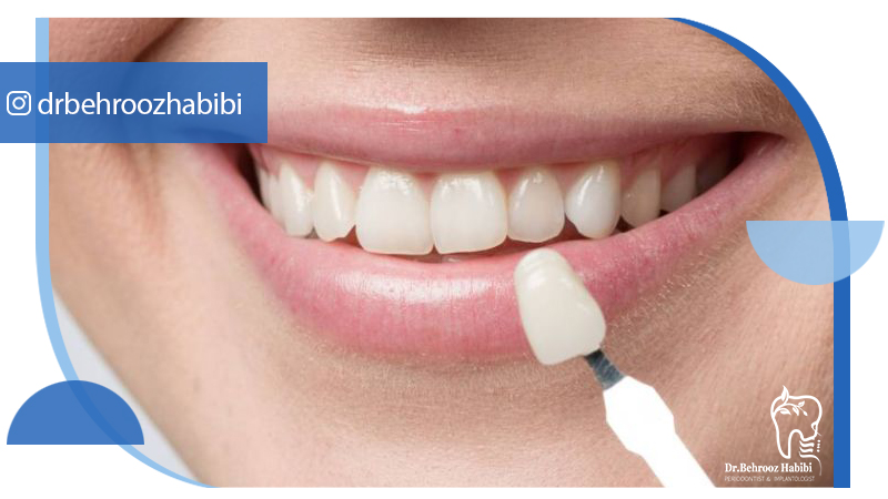 بهترین دکتر ایمپلنت در تهران | دکتر بهروز حبیبی