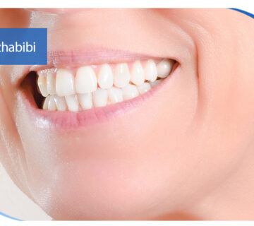 متخصص ایمپلنت تهران | بهترین متخصص ایمپلنت در زعفرانیه تهران