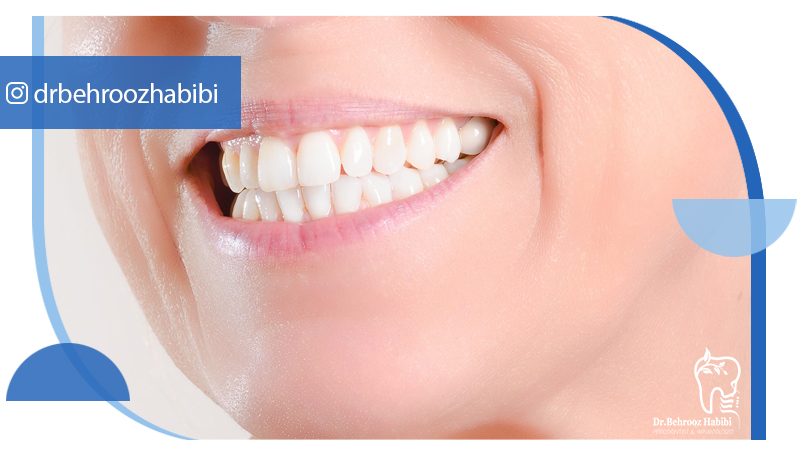 متخصص ایمپلنت تهران | بهترین متخصص ایمپلنت در زعفرانیه تهران