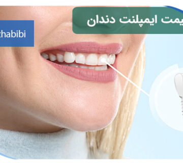 متخصص ایمپلنت تهران | بهترین متخصص ایمپلنت در زعفرانیه تهران