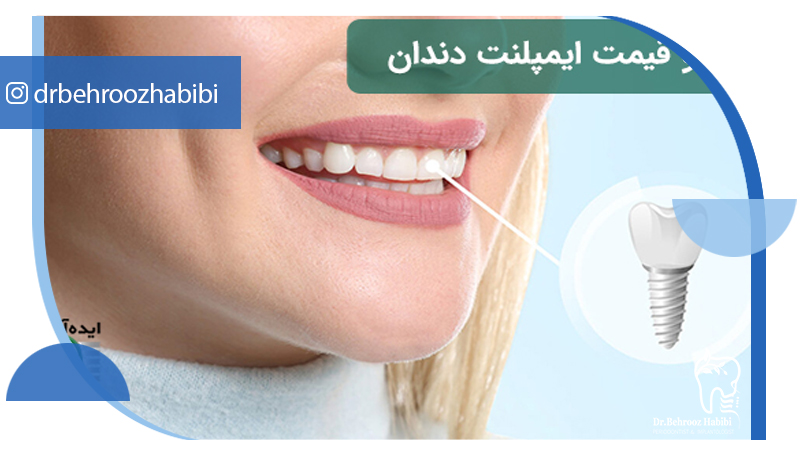 متخصص ایمپلنت تهران | بهترین متخصص ایمپلنت در زعفرانیه تهران