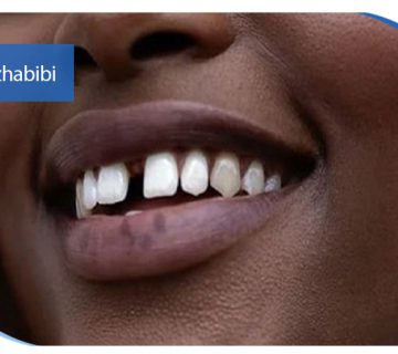 متخصص ایمپلنت تهران | بهترین متخصص ایمپلنت در زعفرانیه تهران | دکتر بهروز حبیبی