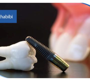 متخصص ایمپلنت تهران | بهترین متخصص ایمپلنت در زعفرانیه تهران | دکتر بهروز حبیبی