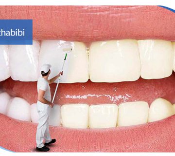 بلیچینگ دندان در تهران