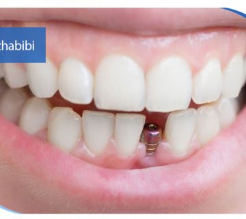 متخصص ایمپلنت و جراحی لثه تهران زعفرانیه